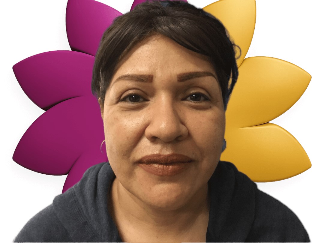 Front view After Upper Blepharoplasty